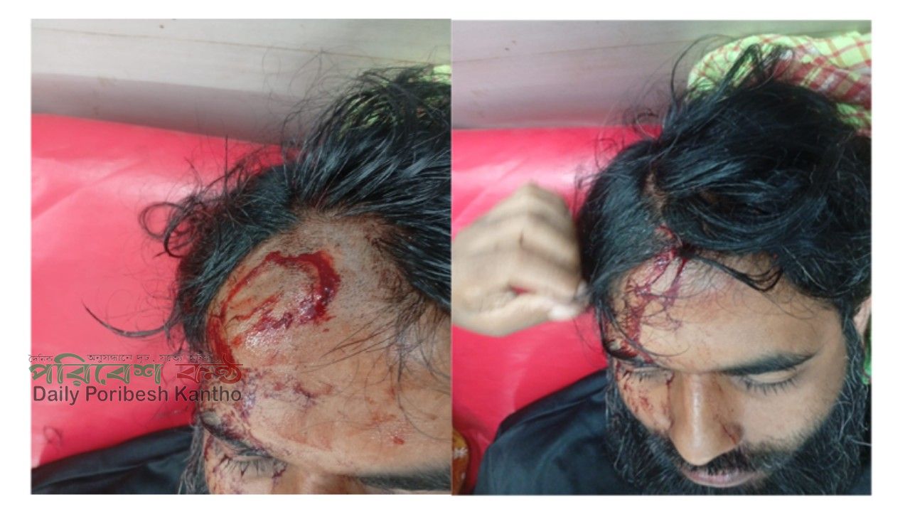তুচ্ছ বিরোধের জেরে অন্তঃসত্ত্বা নারীকে পেটে লাথি, যুবককে কুপিয়ে রক্তাক্ত যখম